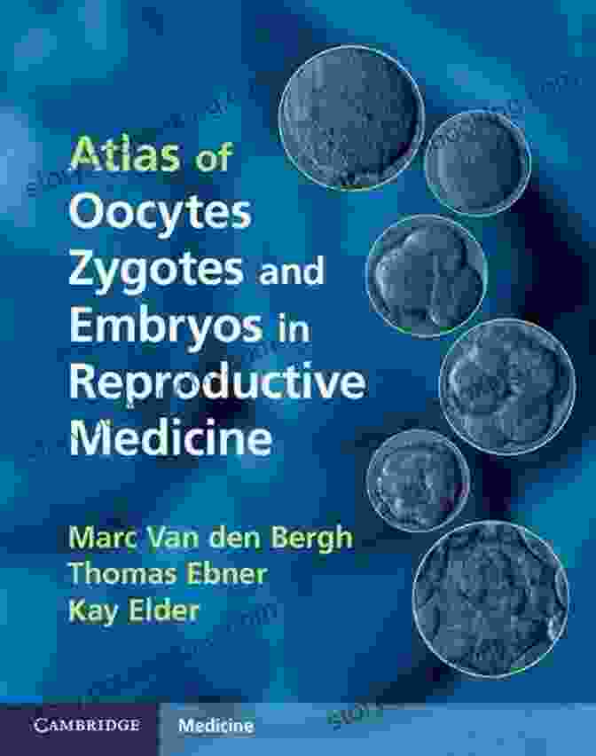 Atlas Of Oocytes, Zygotes, And Embryos In Reproductive Medicine: A Comprehensive Visual Guide Atlas Of Oocytes Zygotes And Embryos In Reproductive Medicine